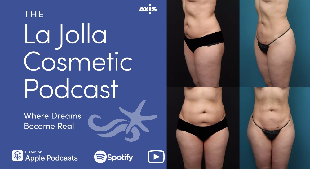 [The La Jolla Cosmetic Podcast logo] photos of Dr. Swistun's patient before (left) vs. after (right) 360 lipo
